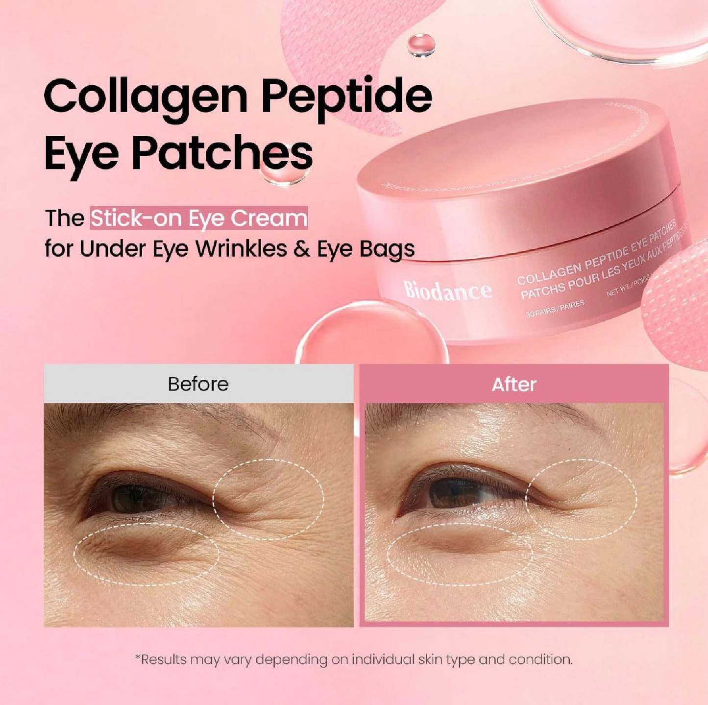 Collagen Peptide Eye Patches (60 Pairs) | Hydrating Under-Eye Mask for Dark Circles & Puffiness