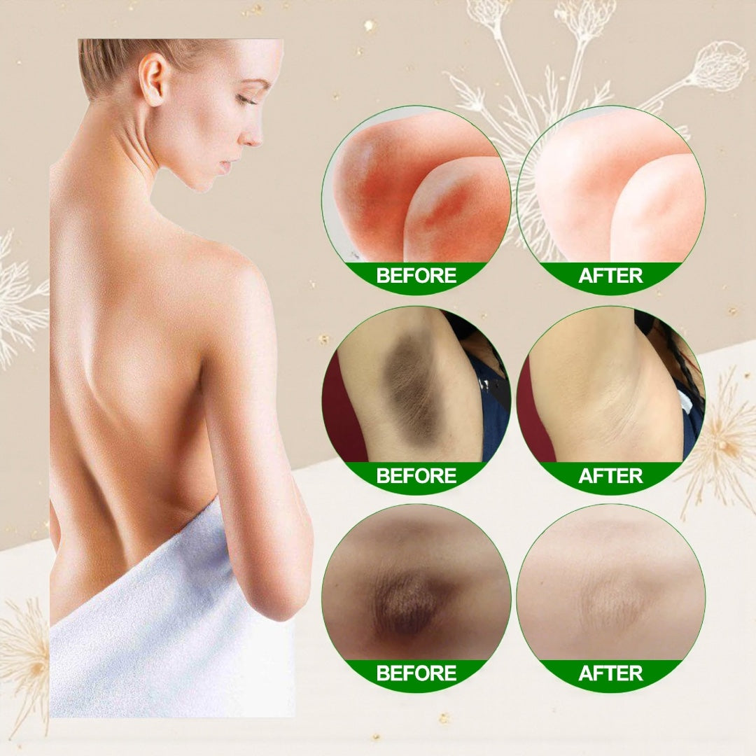 Underarm brightening cream beside towel and body care accessories